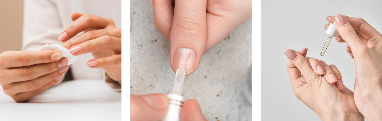 nail recovery after winter